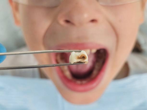 Best Emergency Dentist for Knocked-Out Tooth in Pascagoula, MS
